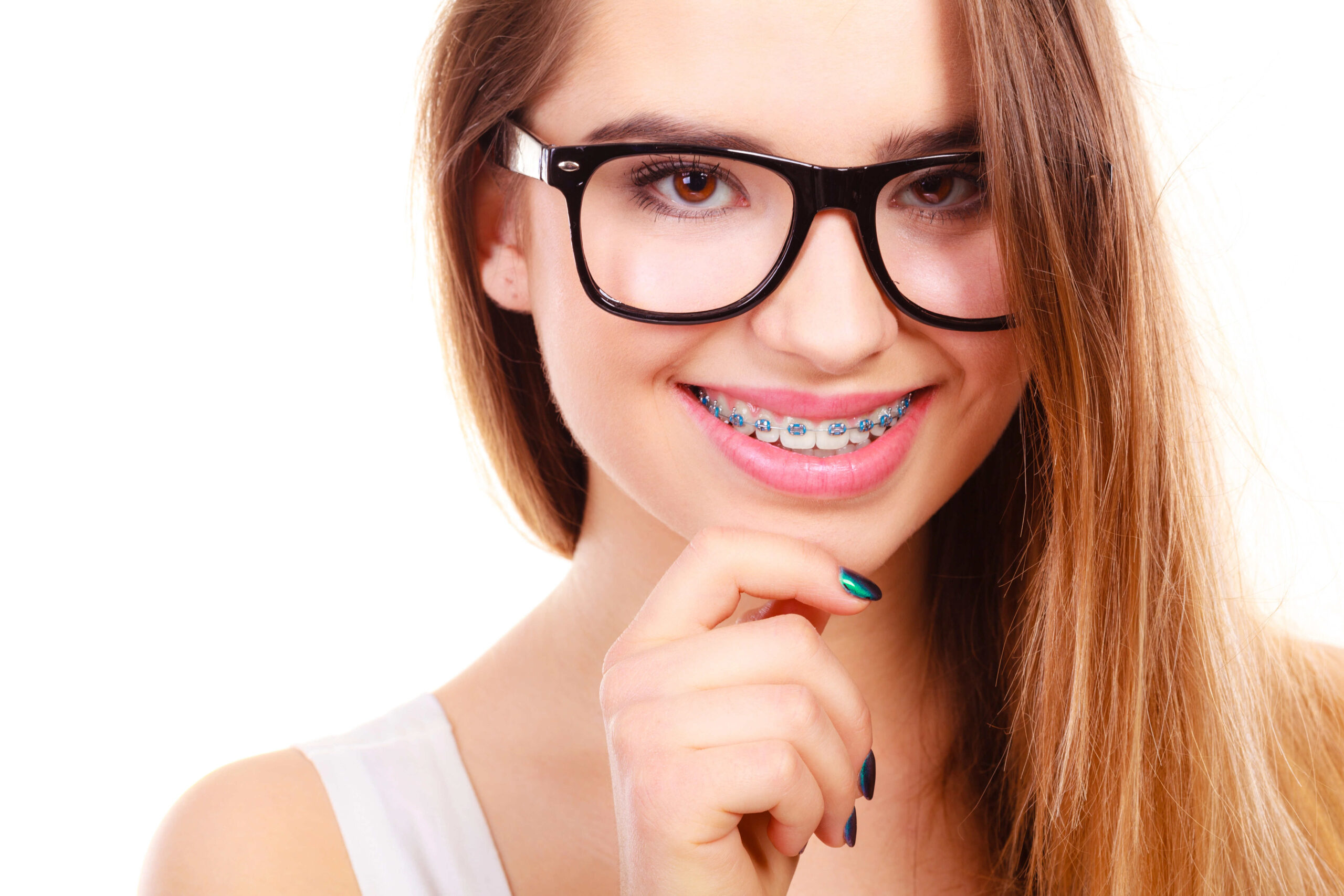 Clear Braces vs Traditional Braces: Style vs Function